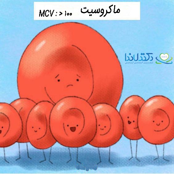 ماکروسیت-MCV